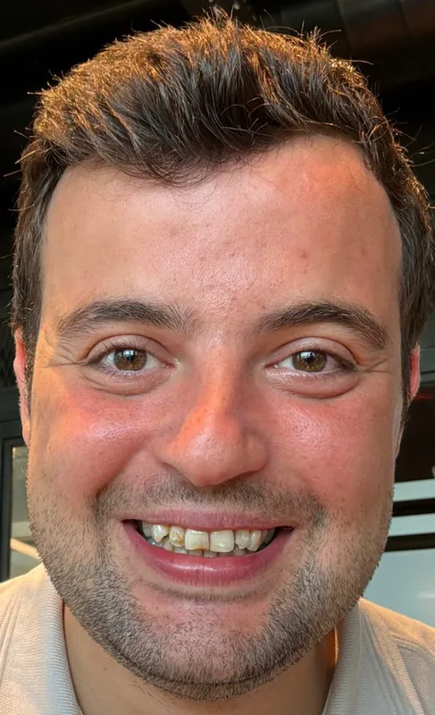 ÖNCE