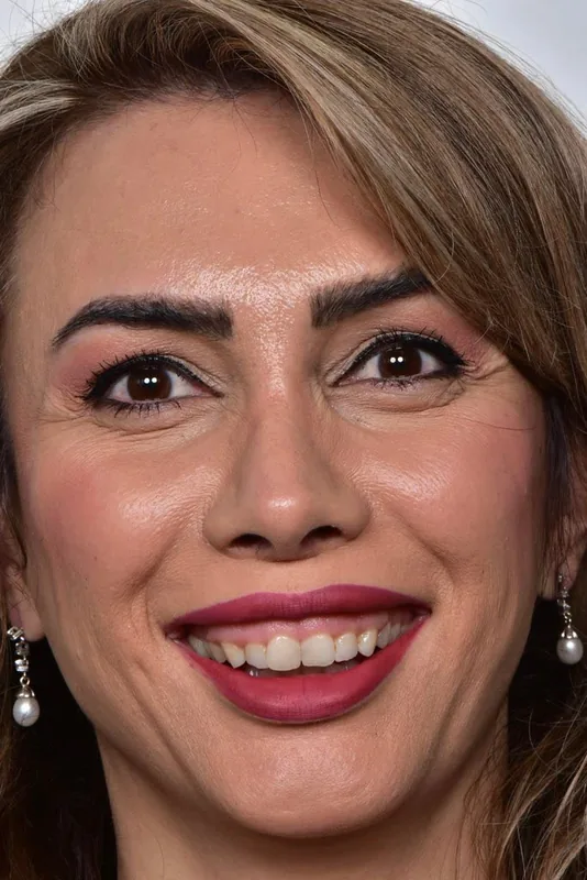 ÖNCE