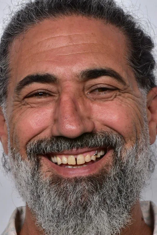 ÖNCE