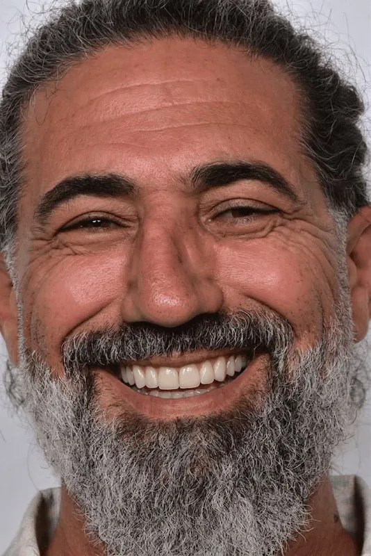 SONRA