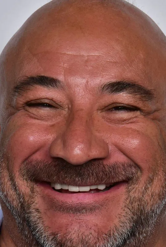 ÖNCE